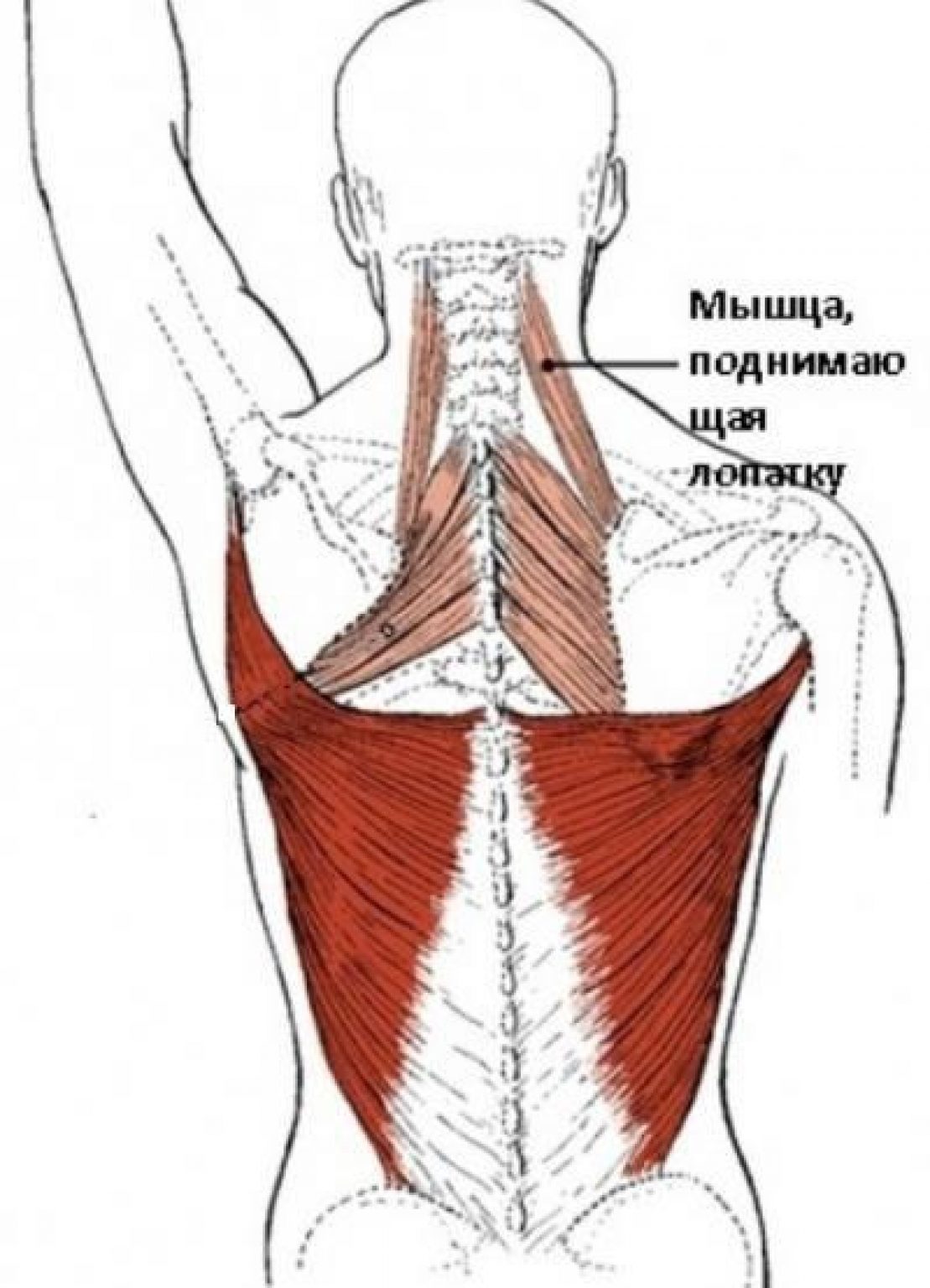 Мышца поднимающая лопатку триггерные точки